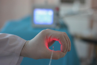 Эндовенозная лазерная облитерация